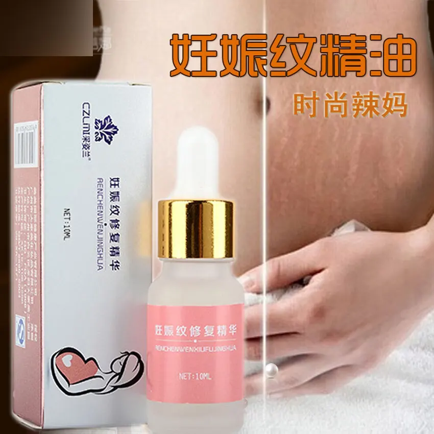 CZLMI Stretch Marks Removing Essential Oil Maternity Bio Oil Skin Care Treatment Acne Scar Removal Cream for Stretch Mark cream
CZLMI Stretch Marks Removing Essential Oil Maternity Bio Oil Skin Care Treatment Acne Scar Removal Cream for Stretch Mark cream