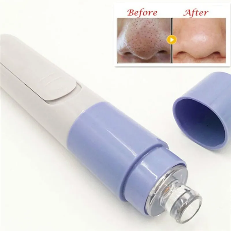 Electric Acne Remover Point Noir Blackhead Vacuum Extractor Tool Black Spots Pore Cleaner Skin Care Massager Face Lift Tool Kit
Electric Acne Remover Point Noir Blackhead Vacuum Extractor Tool Black Spots Pore Cleaner Skin Care Massager Face Lift Tool Kit