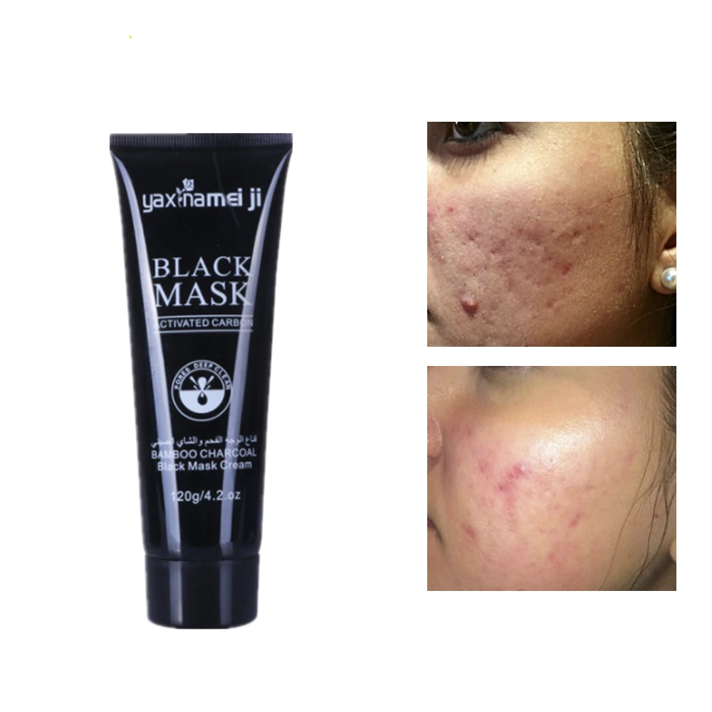 Quick effect Blackhead Remover Black Mask Pore Blackheads Deep Cleansing Purifying Peel Off Acne Black Mud Face Mask 120g/tube
Quick effect Blackhead Remover Black Mask Pore Blackheads Deep Cleansing Purifying Peel Off Acne Black Mud Face Mask 120g/tube