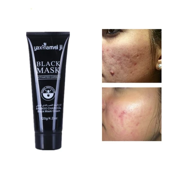 Quick effect Blackhead Remover Black Mask Pore Blackheads Deep Cleansing Purifying Peel Off Acne Black Mud Face Mask 120g/tube
Quick effect Blackhead Remover Black Mask Pore Blackheads Deep Cleansing Purifying Peel Off Acne Black Mud Face Mask 120g/tube