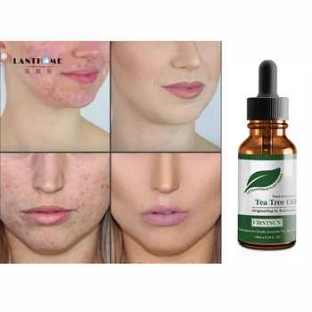 100% Natural Tea Tree Essential Oil Anti-wrinkle Extract Acne Removal Scars Marks Treatment Essential Oil For Any Skin Care
100% Natural Tea Tree Essential Oil Anti-wrinkle Extract Acne Removal Scars Marks Treatment Essential Oil For Any Skin Care