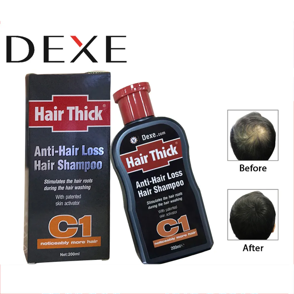 Hot 200ml Anti-Hair Loss Shampoo with Hair Growth Serum Safe Hair Loss Products for All Hair Types Free Shipping
Hot 200ml Anti-Hair Loss Shampoo with Hair Growth Serum Safe Hair Loss Products for All Hair Types Free Shipping