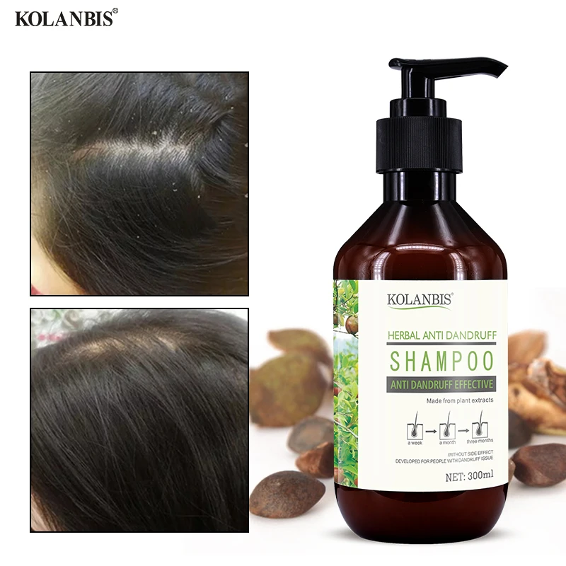 Scalp Care Hair Anti Dandruff Shampoo Nutrition Nourish Tea Tree Oil Product Oily Control Treatment Hair Refreshing Anti Itchy
Scalp Care Hair Anti Dandruff Shampoo Nutrition Nourish Tea Tree Oil Product Oily Control Treatment Hair Refreshing Anti Itchy
