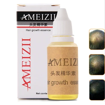 Hair Growth Anti Hair Loss Liquid 20ml Dense Hair Fast Sunburst Hair Growth Grow Alopecia
Hair Growth Anti Hair Loss Liquid 20ml Dense Hair Fast Sunburst Hair Growth Grow Alopecia