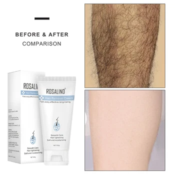 ROSALIND Hair Removal Cream Underarm Hand Cream Painless Effective Wax Depiladora Facial Hair Remover Smooth Care Depilator
ROSALIND Hair Removal Cream Underarm Hand Cream Painless Effective Wax Depiladora Facial Hair Remover Smooth Care Depilator