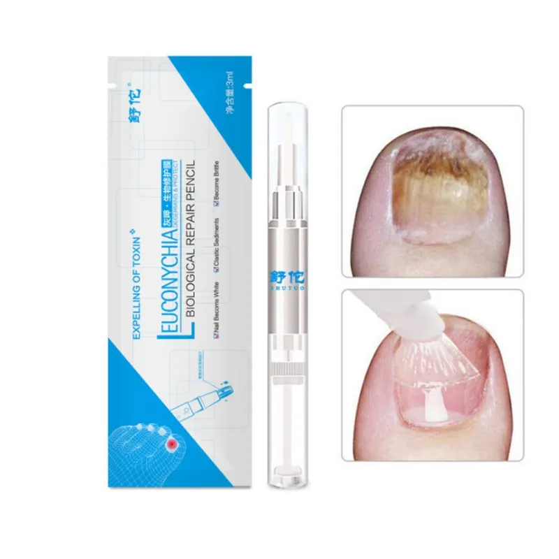 Gray Nail For Nail Bright Antibacterial Liquid Film Painless Goodbye Oil Products Brighten Nails Gray Removal Q1
Gray Nail For Nail Bright Antibacterial Liquid Film Painless Goodbye Oil Products Brighten Nails Gray Removal Q1