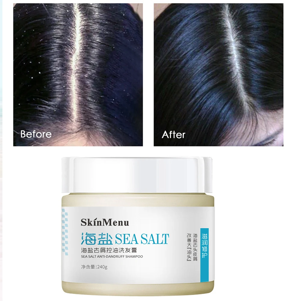 NEW Anti-Dandruff Sea Salt Shampoo Control Oil Relieve Itching Anti-Mite Reducing Dandruff Hair Shampoos Hair Care 240g TSLM2
NEW Anti-Dandruff Sea Salt Shampoo Control Oil Relieve Itching Anti-Mite Reducing Dandruff Hair Shampoos Hair Care 240g TSLM2