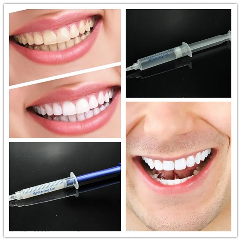 Free Shipping 10 Pieces*5ml 44% Carbamide Peroxide Gel Teeth Tooth Whitening Whitener Bleaching Syringes Back to Bright Smile
Free Shipping 10 Pieces*5ml 44% Carbamide Peroxide Gel Teeth Tooth Whitening Whitener Bleaching Syringes Back to Bright Smile