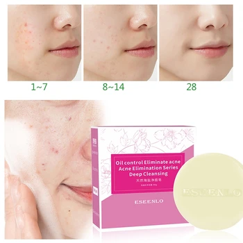 Removal Pimple Pore Acne Treatment Sea Salt Soap Cleaner Moisturizing Oil control Deep Cleaning Face Care Wash Soap
Removal Pimple Pore Acne Treatment Sea Salt Soap Cleaner Moisturizing Oil control Deep Cleaning Face Care Wash Soap