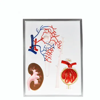 Nephron Renal Corpuscle Scale-up Model Human Realistic Renal Anatomical Structure Biomedical Science Demonstration Teaching Aids
Nephron Renal Corpuscle Scale-up Model Human Realistic Renal Anatomical Structure Biomedical Science Demonstration Teaching Aids