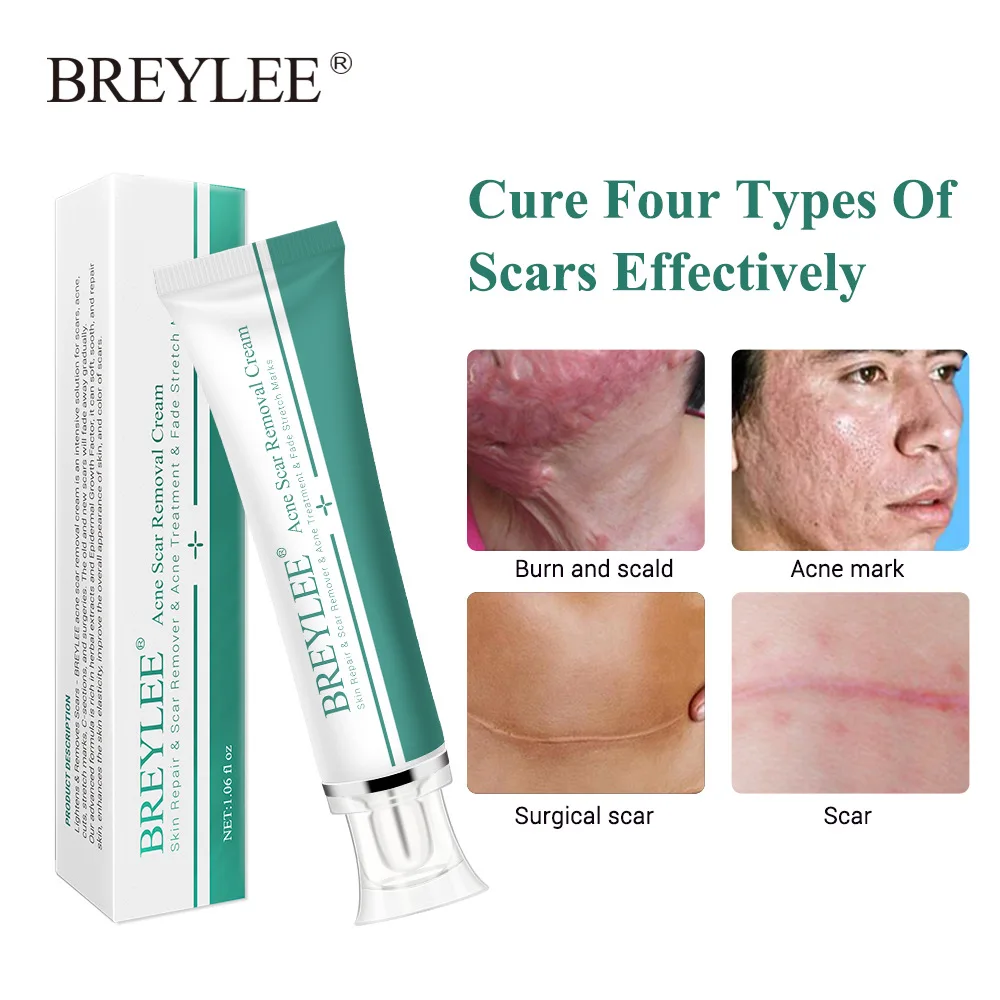 New 30g Acne Scar Removal Cream Skin Repair Face Cream Acne Spots Acne Treatment Whitening Cream Stretch Marks Skin Care Tslm2 Facial Self Tanners Bronzers Aliexpress