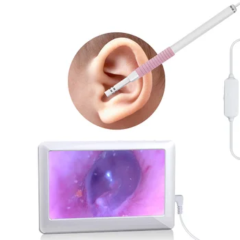 5.5mm Lens Ear Cleaning Endoscope 4.3 Inch HD Display Screen Visual Ear Spoon Endoscope Visible Ear Cleaning Tool with 6 LEDs
5.5mm Lens Ear Cleaning Endoscope 4.3 Inch HD Display Screen Visual Ear Spoon Endoscope Visible Ear Cleaning Tool with 6 LEDs
