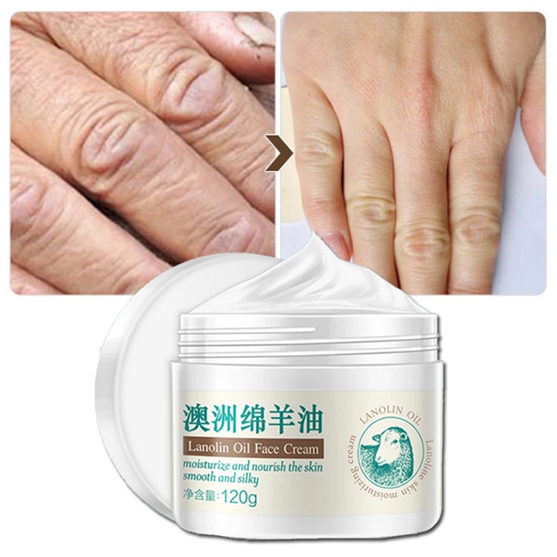 Sheep oil Essence Nourish Cream Moisturizing Cream Improve Dry Face Skin Care Whitening Facial Care Face Cream 120g LAIKOU
Sheep oil Essence Nourish Cream Moisturizing Cream Improve Dry Face Skin Care Whitening Facial Care Face Cream 120g LAIKOU
