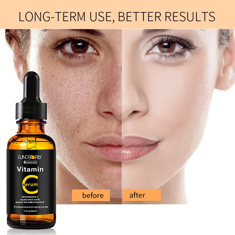 Lundborly 30ml Hyaluronic acid serum Anti Wrinkle vitamin c skin care Remove Acne Facial Cream natural face serum
Lundborly 30ml Hyaluronic acid serum Anti Wrinkle vitamin c skin care Remove Acne Facial Cream natural face serum