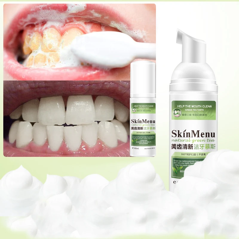 Advanced Tooth Whitening Clean Tooth Bubble Teeth Whitening Tool Cleaning Whitener Brush Charcoal Teeth Whitening Stains Remover
Advanced Tooth Whitening Clean Tooth Bubble Teeth Whitening Tool Cleaning Whitener Brush Charcoal Teeth Whitening Stains Remover