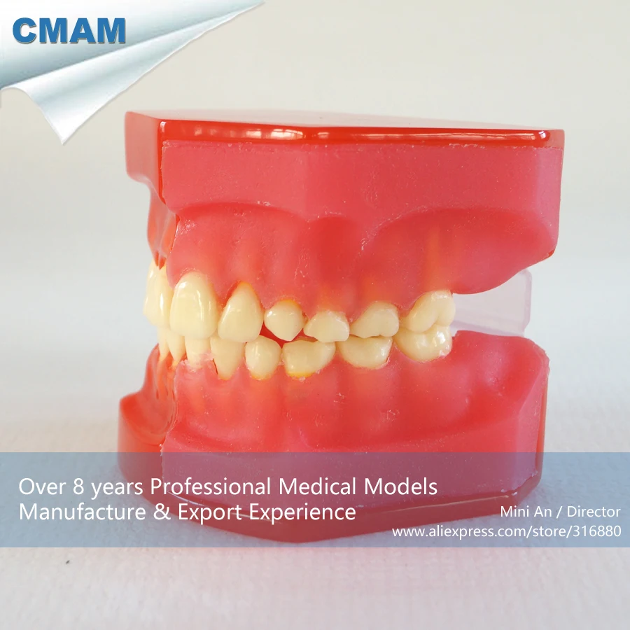 CMAM-DH502 Child Tooth 5-9 Age Graghically Dental Teeth Developing Model