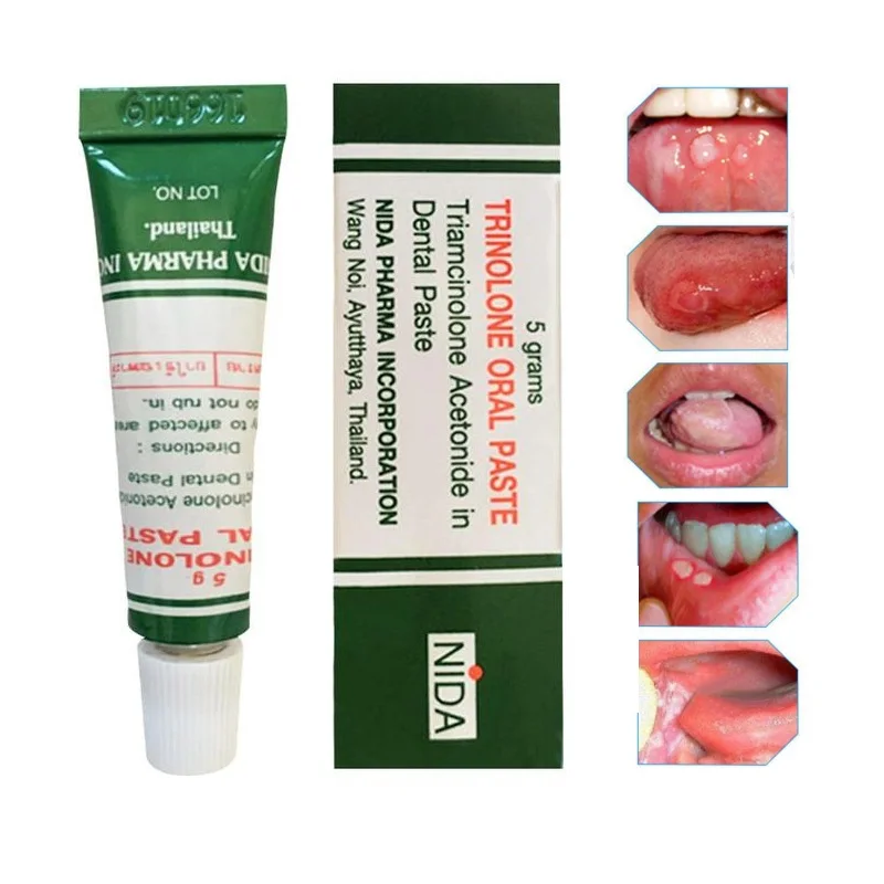 Mouth Ulcer Relief Gel Natural Herbal Oral Antibacterial Cream Fast Relief From Severe Pain & Irritation Within 2 Minutes
Mouth Ulcer Relief Gel Natural Herbal Oral Antibacterial Cream Fast Relief From Severe Pain & Irritation Within 2 Minutes