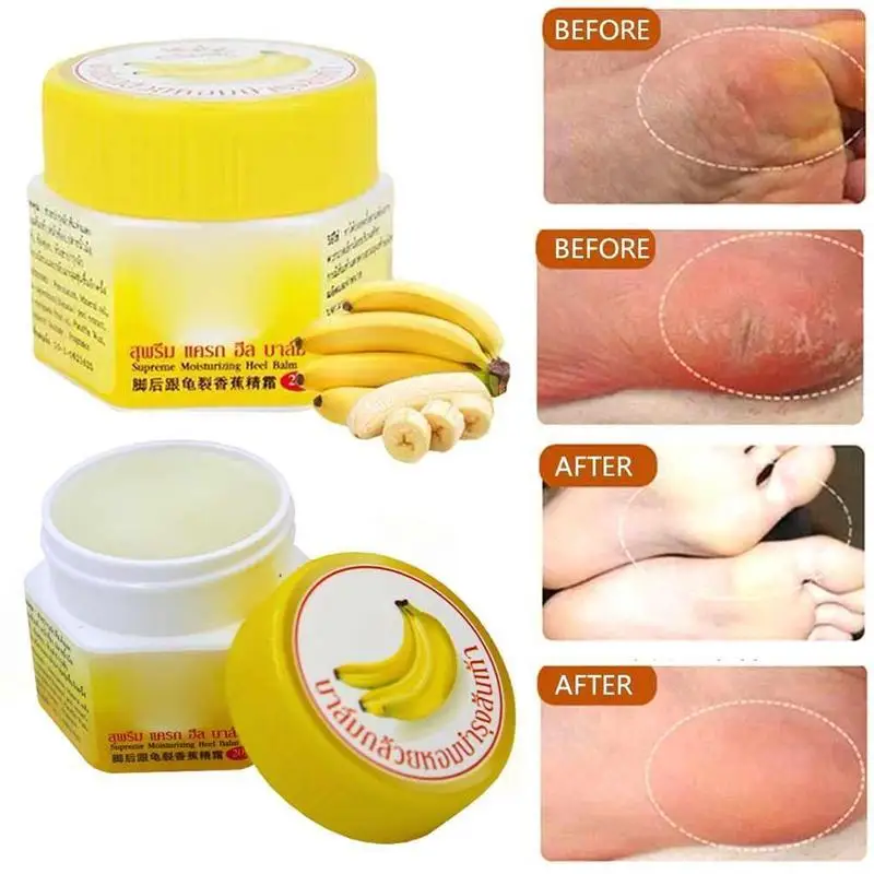 Thailand Banana Skin Cream Moisturizing Heel Prevent Dry Crack Ointment Foot Care Balm Crack Relief Whitening Smooth Skin Creams
Thailand Banana Skin Cream Moisturizing Heel Prevent Dry Crack Ointment Foot Care Balm Crack Relief Whitening Smooth Skin Creams