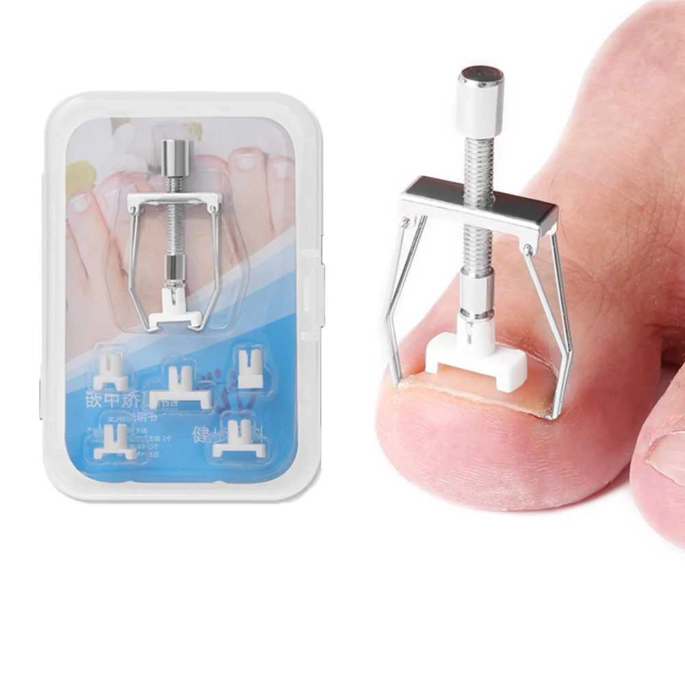 Ingrown Toenail Correction Tool Nail Corrector Tool Kit Toe Paronychia Nail Brace Pedicure Care Tool
Ingrown Toenail Correction Tool Nail Corrector Tool Kit Toe Paronychia Nail Brace Pedicure Care Tool