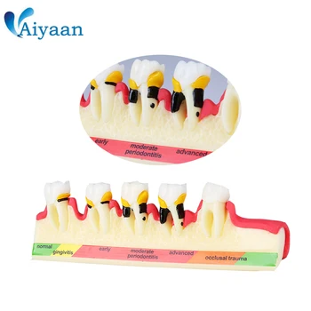 1 Pc Dental Teeth Model for Periodontal Diseases' Assorting & Pathology Tooth Classification M-4010
1 Pc Dental Teeth Model for Periodontal Diseases' Assorting & Pathology Tooth Classification M-4010