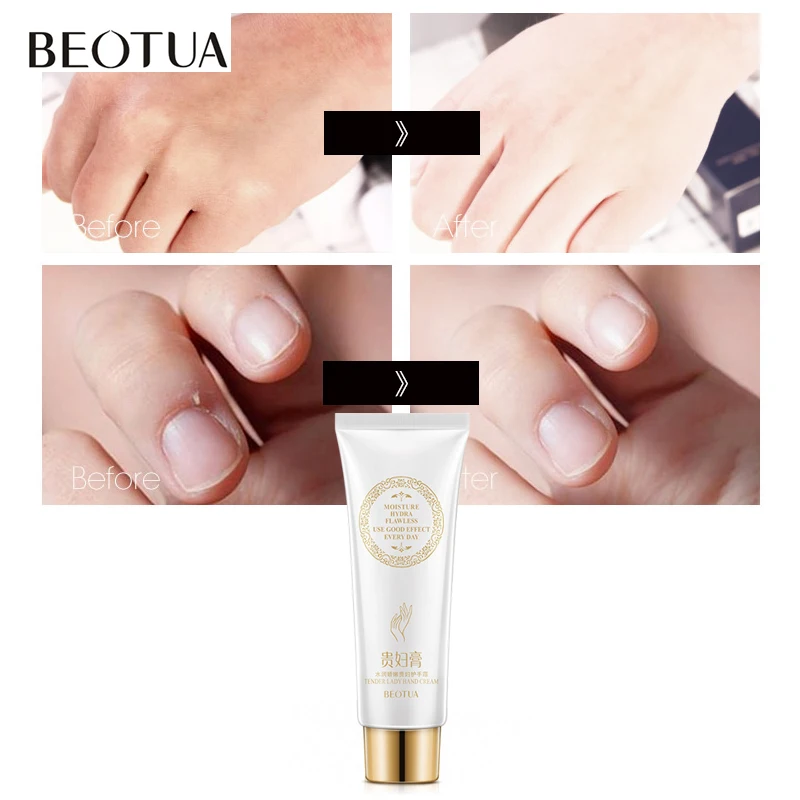 BEOATUA Lady Plant Extract Hand Cream Skin Care Moisturizing Hydra Nourishing Whitening Hydra Care Cream Fragrance Beauty Skin
BEOATUA Lady Plant Extract Hand Cream Skin Care Moisturizing Hydra Nourishing Whitening Hydra Care Cream Fragrance Beauty Skin