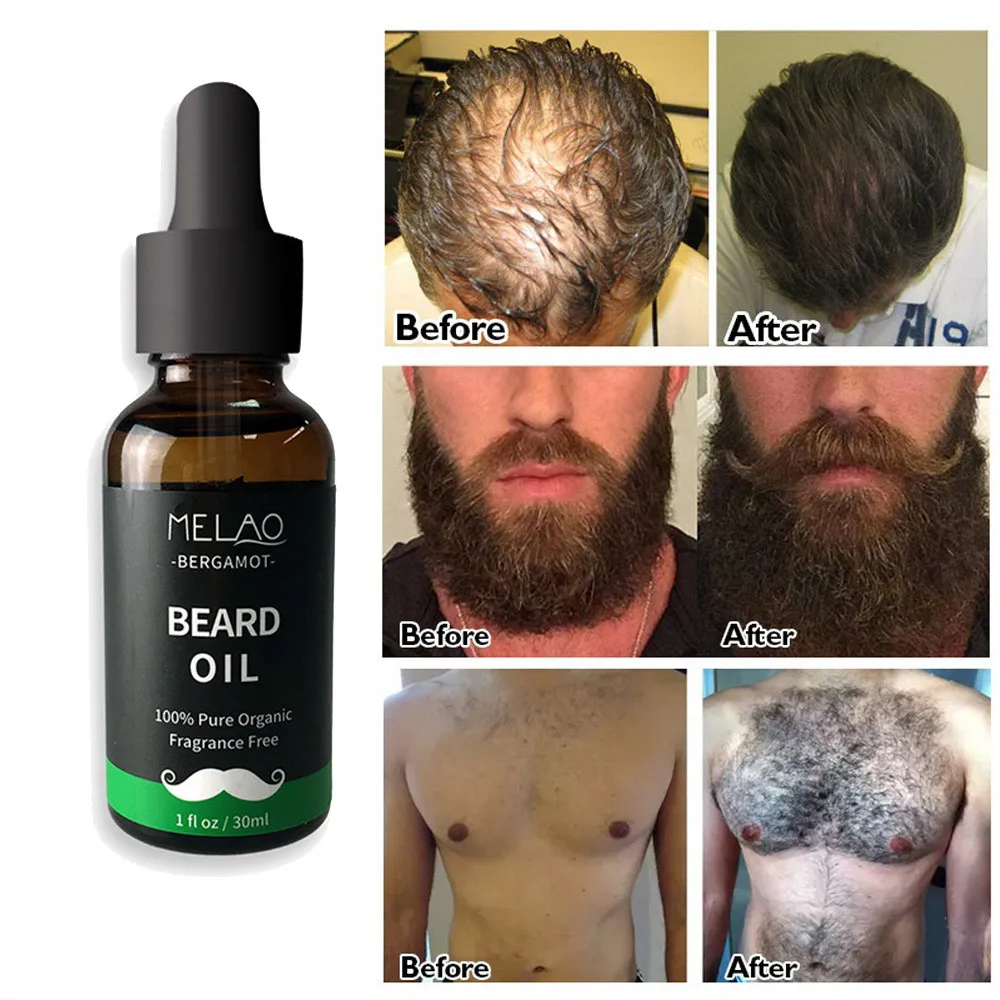 100% Pure Organic Fragrance Free Nourishing Oil 30ml Men Liquid Beard Growth Fast Enhance Facial Whiskers Nutrition Moustache
100% Pure Organic Fragrance Free Nourishing Oil 30ml Men Liquid Beard Growth Fast Enhance Facial Whiskers Nutrition Moustache