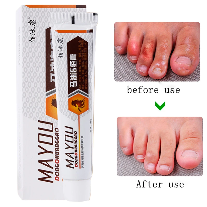 Powerful Horse Oil Hand Foot Crack Cream Heel Chapped Peeling Foot and Hand Repair Anti Chapping Wrinkle Treatment Skin Cracking
Powerful Horse Oil Hand Foot Crack Cream Heel Chapped Peeling Foot and Hand Repair Anti Chapping Wrinkle Treatment Skin Cracking
