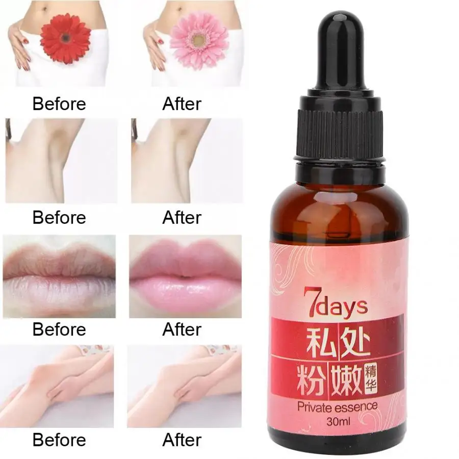 Women 30ml Private Essence Skin Lightening Underarm Nipple Bleaching Lip Rejuvenating Pinkish Serum
Women 30ml Private Essence Skin Lightening Underarm Nipple Bleaching Lip Rejuvenating Pinkish Serum