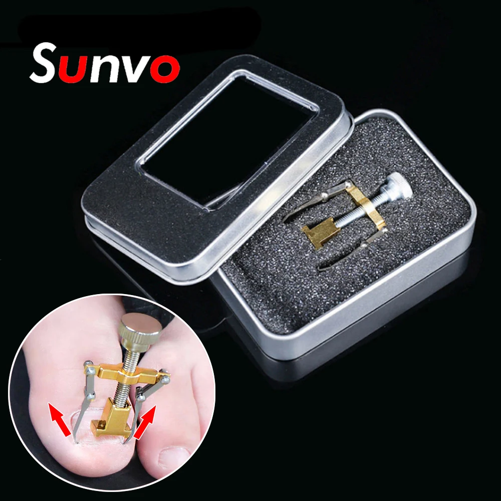 Sunvo Toe Nail Correction Tool for Ingrown Nail Paronychia Pedicure Recover Fixer Orthotic Corrector Foot Care Orthopedic Insole
Sunvo Toe Nail Correction Tool for Ingrown Nail Paronychia Pedicure Recover Fixer Orthotic Corrector Foot Care Orthopedic Insole