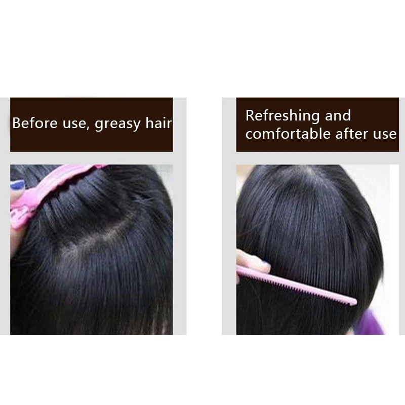 Фото Эссенция для быстрого роста волос масло экстракта имбиря спрей | Уход за волосами и кожей головы (33036152169)