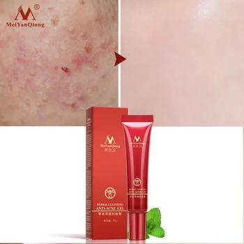 High Efficient Herbal Cleansing Face Anti-acne Treatment Cream Herbal Scar Removal Oily Skin Acne Spots Face Skin Care
High Efficient Herbal Cleansing Face Anti-acne Treatment Cream Herbal Scar Removal Oily Skin Acne Spots Face Skin Care