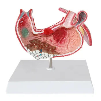 Gastric Anatomic Model Gastric Pathological Model Gastric Disease Demonstration Model Gastric Anatomic Stomach Pathological Mode
Gastric Anatomic Model Gastric Pathological Model Gastric Disease Demonstration Model Gastric Anatomic Stomach Pathological Mode
