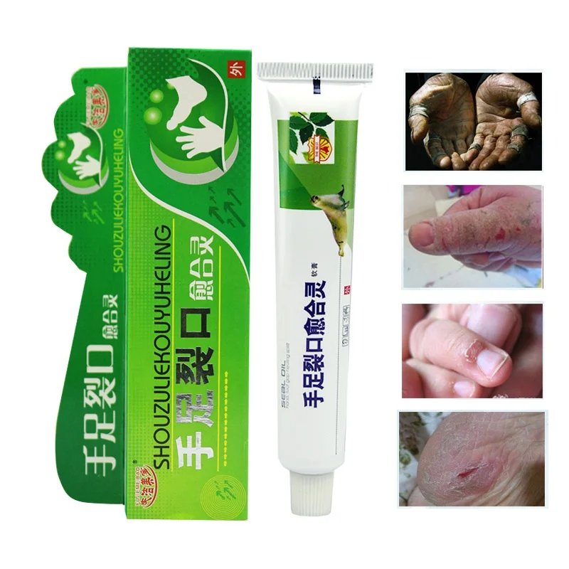 Anti Dry Crack Chapping Fissures Heel Peeling Heal Hand Cream Cleft Healing Cream Chilblain Hand Foot Care Cream
Anti Dry Crack Chapping Fissures Heel Peeling Heal Hand Cream Cleft Healing Cream Chilblain Hand Foot Care Cream