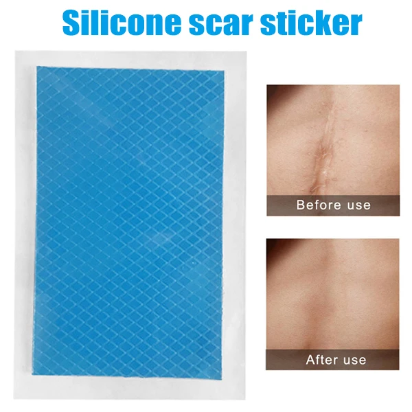 2018 Newly Silicone Scar Therapy Sticker Remove Trauma Burn Silicon Patch Reusable Acne Gel Skin Repair Promotion Price
2018 Newly Silicone Scar Therapy Sticker Remove Trauma Burn Silicon Patch Reusable Acne Gel Skin Repair Promotion Price