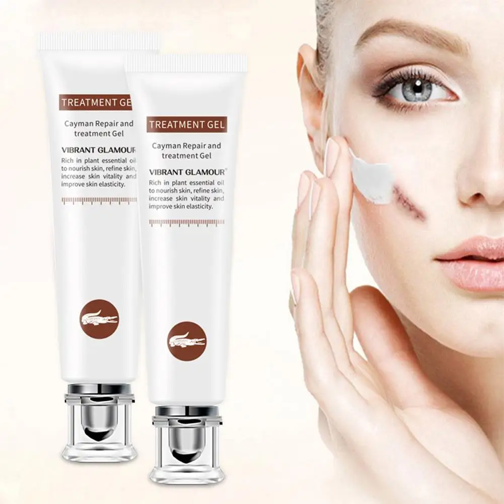 Repair Scar Removal Cream Gel Stretch Remove Acne Car Treatment Pimple Repair Body Skin Cream For Burns Dilute Scars Firm Skin
Repair Scar Removal Cream Gel Stretch Remove Acne Car Treatment Pimple Repair Body Skin Cream For Burns Dilute Scars Firm Skin
