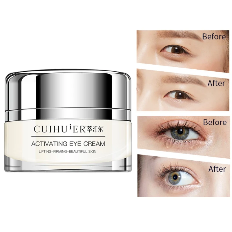 Activating Skin Firming Eye Cream Whitening Moisturizing Hydrating Anti Wrinkle Remove Dark Circles Eye Creams Skin Care Hot
Activating Skin Firming Eye Cream Whitening Moisturizing Hydrating Anti Wrinkle Remove Dark Circles Eye Creams Skin Care Hot