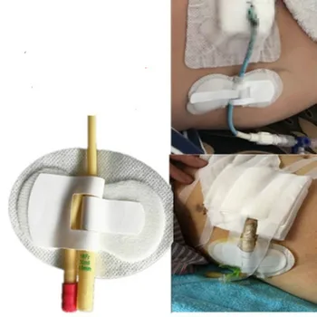 11pcs/lot foley catheter holder homecare fixed stick catheter care non-woven adhesive holder sterilized fixed tube size11*6cm
11pcs/lot foley catheter holder homecare fixed stick catheter care non-woven adhesive holder sterilized fixed tube size11*6cm