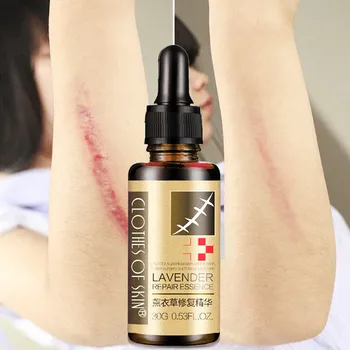 LAIKOU Scar Repair Skin Essential Massage Oil Lavender Repair Essence dilute scar Natural Pure Remove Ance Hyaluronic Acid Serum
LAIKOU Scar Repair Skin Essential Massage Oil Lavender Repair Essence dilute scar Natural Pure Remove Ance Hyaluronic Acid Serum