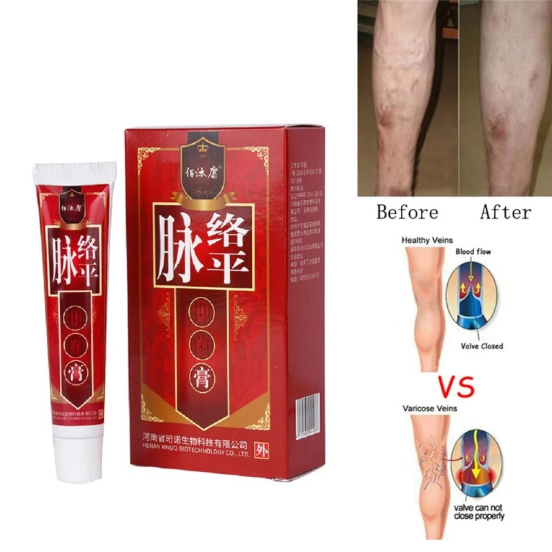 1 pc Varicose Veins Treatment Body Cream Spider Veins Pain Varicosity Angiitis Removal Herbal Cream Body CreamsS1
1 pc Varicose Veins Treatment Body Cream Spider Veins Pain Varicosity Angiitis Removal Herbal Cream Body CreamsS1