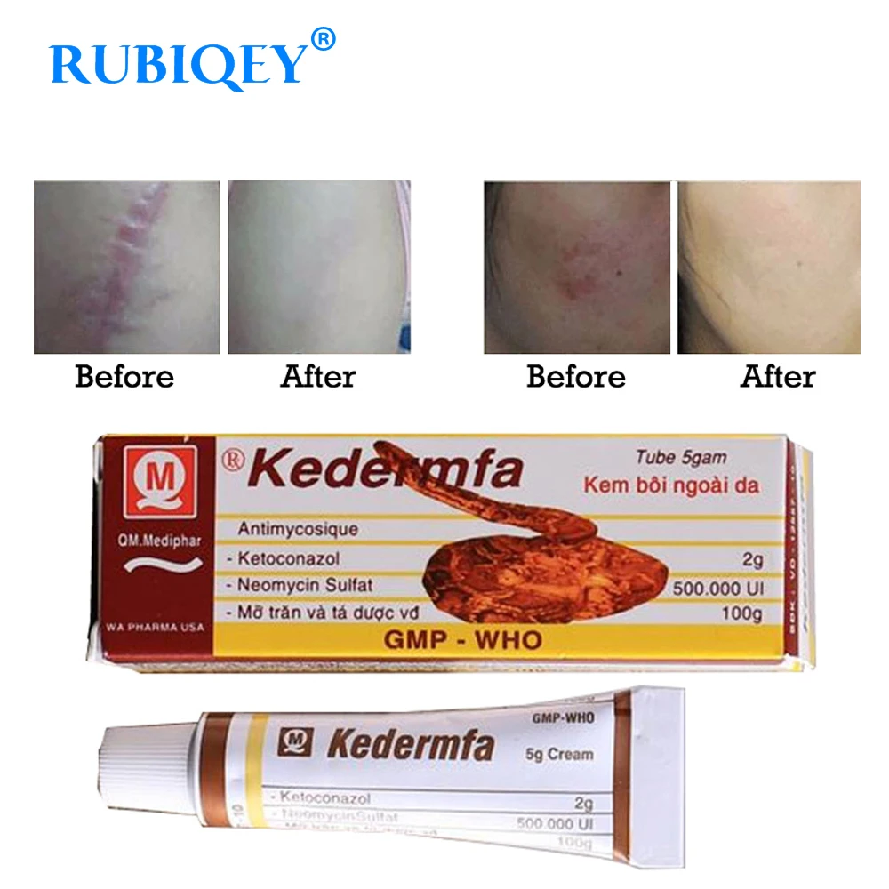 Repair Chilblain Hand Foot Care Cream Anti Dry Crack Chapping Fissures Heal Exfoliating Ointment Hands Feet Cream 2018 New 5g
Repair Chilblain Hand Foot Care Cream Anti Dry Crack Chapping Fissures Heal Exfoliating Ointment Hands Feet Cream 2018 New 5g