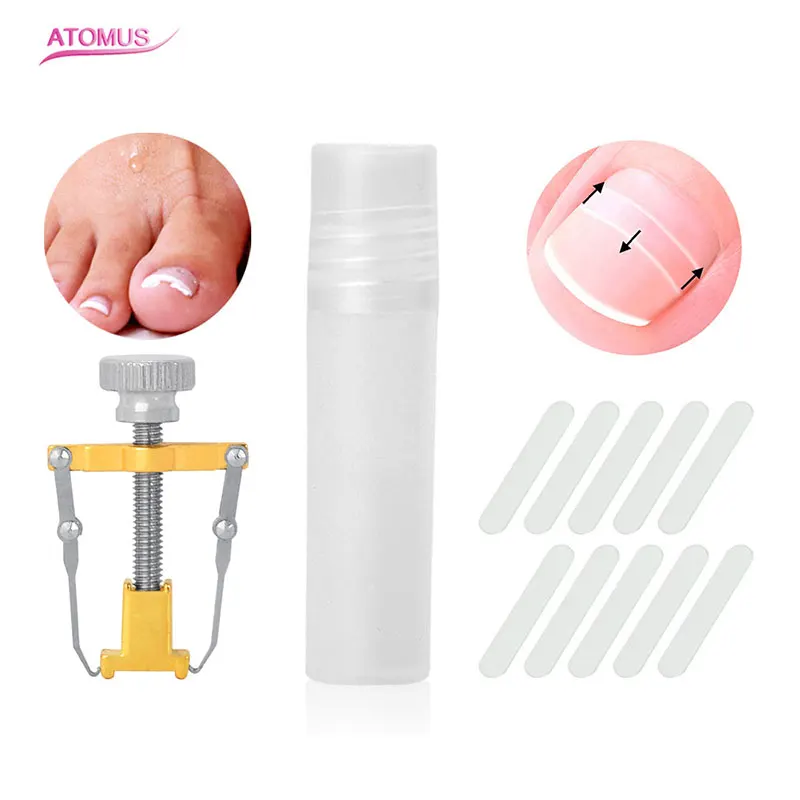ATOMUS Toe Nail Recover Correction Tool Set Ingrown Toe Nail Pedicure Professional Nail Fixer With Patch Foot Nail Care
ATOMUS Toe Nail Recover Correction Tool Set Ingrown Toe Nail Pedicure Professional Nail Fixer With Patch Foot Nail Care