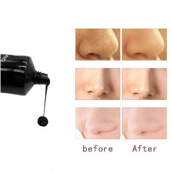 DISAAR Black Mask Peel Off Bamboo Charcoal Deep Purifying Blackhead Remover Mask Cleansing Pore Acne Scars Blemishes skin care
DISAAR Black Mask Peel Off Bamboo Charcoal Deep Purifying Blackhead Remover Mask Cleansing Pore Acne Scars Blemishes skin care