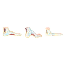 1:1 Lifesize Human Normal/ Flat Foot Model Anatomique Pied with Ligaments Bones Muscles Medical Anatomical Study Kit
1:1 Lifesize Human Normal/ Flat Foot Model Anatomique Pied with Ligaments Bones Muscles Medical Anatomical Study Kit