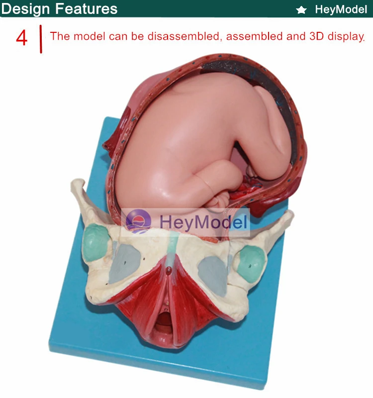 4 _