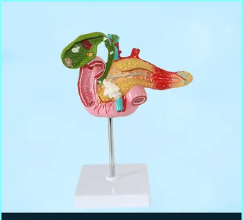 Human Pathological Changes Pancreas and Spleen Gall Bladder Duodenum Illness Model Cholecystitis Gallbladder Gallstones Model
Human Pathological Changes Pancreas and Spleen Gall Bladder Duodenum Illness Model Cholecystitis Gallbladder Gallstones Model