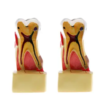 2pcs 1: 1 Tooth Decay Model Human Dental Medical Anatomical Model for School Teaching Tool Learning Display Lab Supplies
2pcs 1: 1 Tooth Decay Model Human Dental Medical Anatomical Model for School Teaching Tool Learning Display Lab Supplies