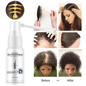 1PC Dry Hair Regeneration Repair Anti Hair Loss Hair Growth Spray Essential Oil Liquid For Men Women Hair Loss Products Hair Car
1PC Dry Hair Regeneration Repair Anti Hair Loss Hair Growth Spray Essential Oil Liquid For Men Women Hair Loss Products Hair Car