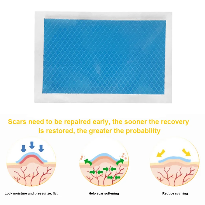 Silicone Scar Therapy Sticker Remove Trauma Burn Silicon Patch Reusable Acne Gel Skin Repair JS88
Silicone Scar Therapy Sticker Remove Trauma Burn Silicon Patch Reusable Acne Gel Skin Repair JS88
