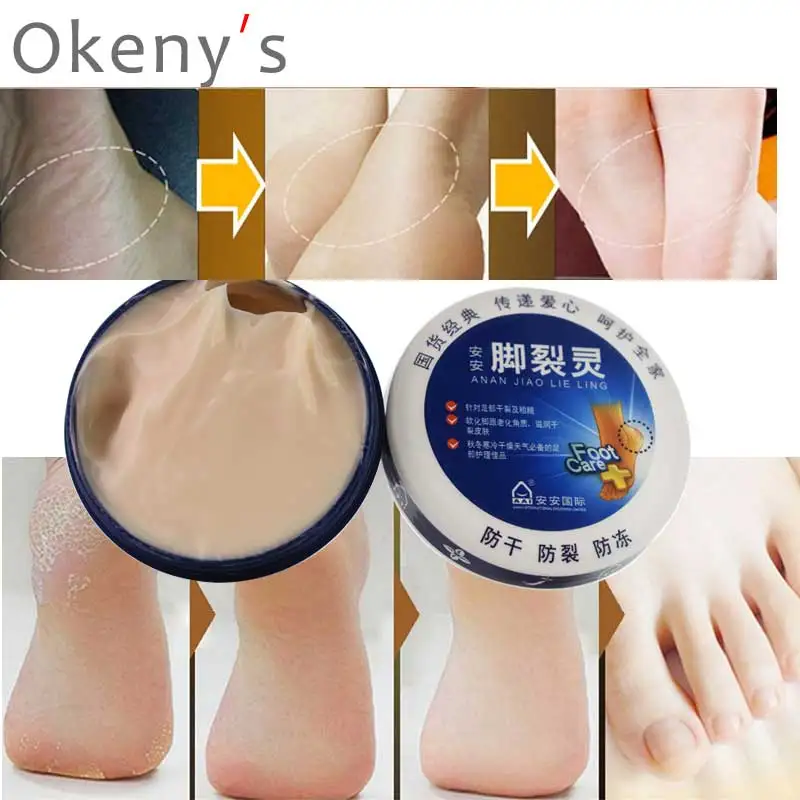 Chinese Foot Ointment Anti Dry Crack Repair Heel Feet Care Foot Balm Exfoliating Foot Cream Hand Cracked Heel Cream 38G
Chinese Foot Ointment Anti Dry Crack Repair Heel Feet Care Foot Balm Exfoliating Foot Cream Hand Cracked Heel Cream 38G