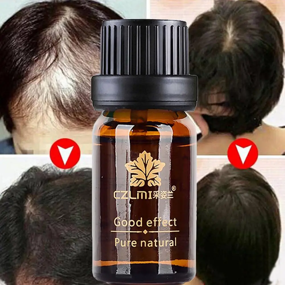 Hair Growth Liquid Essence Oils Thinning Hair Beauty Support Anti